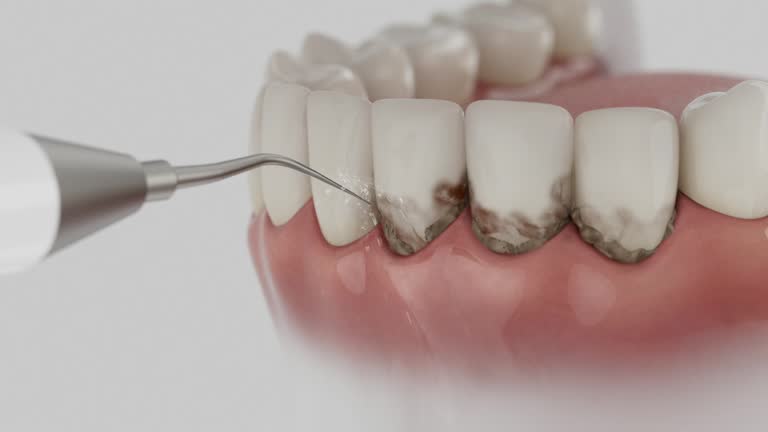 Trusted Teeth Cleaning And Checkup service in Somerset, NJ - Dentist Open Now